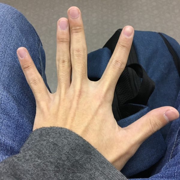 音大生で局所性ジストニアを発症。私が再びフルートを吹けるようになるまで